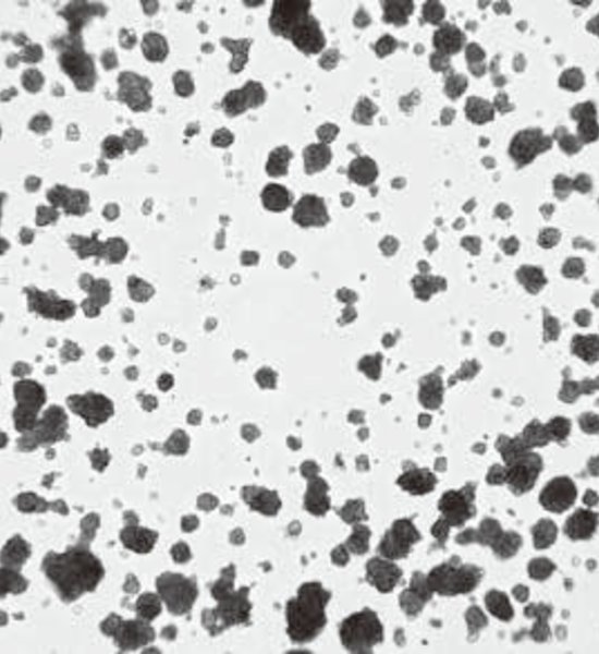 Tumor spheroids - 3D Cell Culture by using Matrigel®