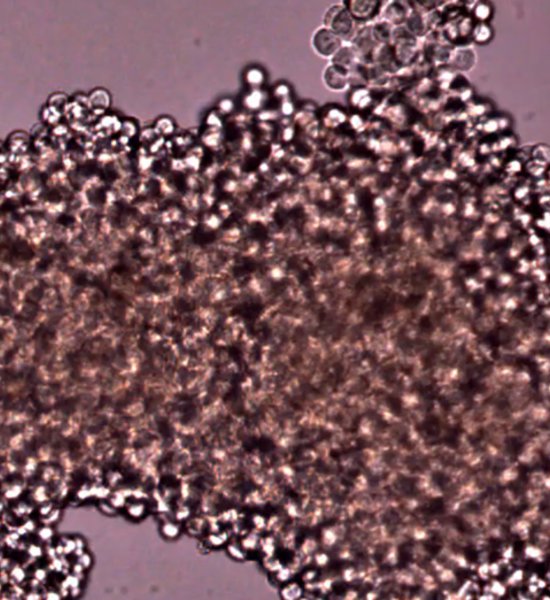 Hybridoma colonies - Single Cell Cloning Hybridoma