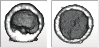 3D Time-lapse observation for embryoid bodies formation. EBs are differentiation of human embryonic stem cells into embryoid bodies compromising the three embryonic germ layers. 