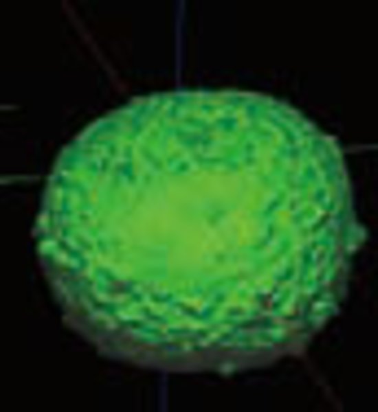 Tumor Spheroid - Real volume of spheroids 