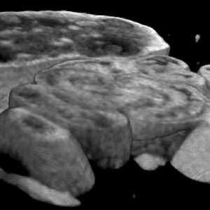 3D ex vivo imaging  - Whole tissue imaging - mouse ovary