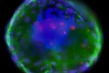 2D Cell Culture  | fluorescence 3D imaging 