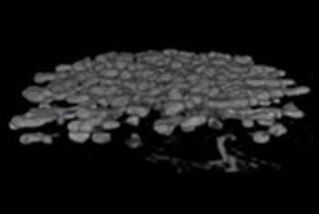3D ex vivo imaging - Kidney  Tumor spheroids