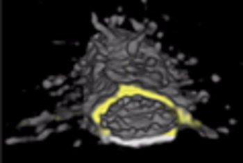 3D ex vivo imaging - Neovasculature Tumor spheroids